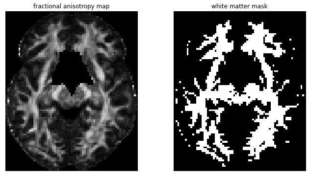 ../../../_images/dMRI_intro_13_0.png