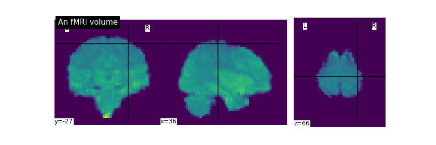 ../../../_images/fmri_example.png