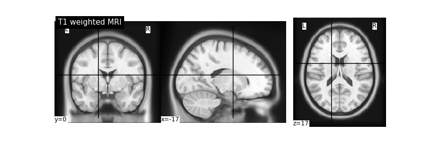 ../../../_images/mri_example.png