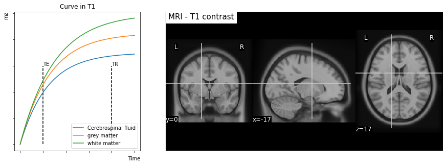 ../../../_images/mri_intro_7_0.png