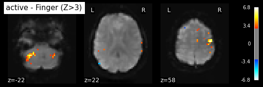 ../../../_images/statistical_analyses_MRI_41_0.png