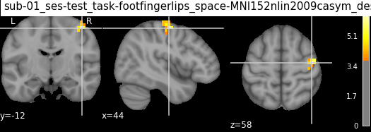 ../../../_images/statistical_analyses_MRI_69_0.png
