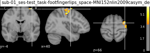 ../../../_images/statistical_analyses_MRI_71_0.png