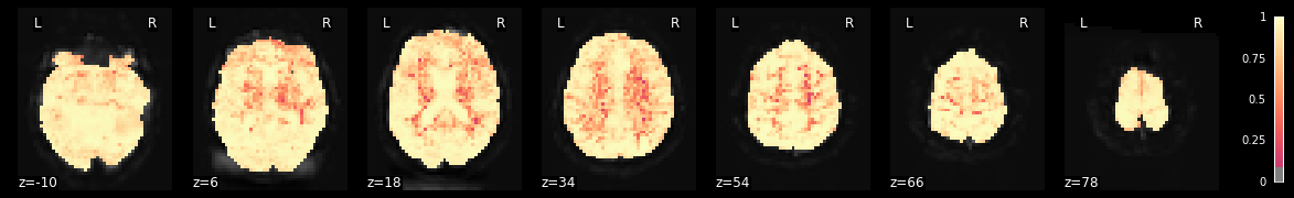 ../../../_images/statistical_analyses_MRI_96_1.png