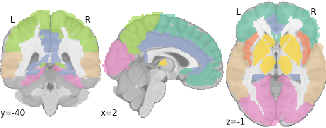 plot AAL example