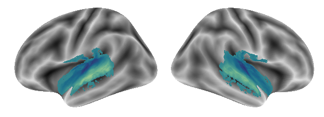 _images/Connectivity_analyses-voxel_100_0.png