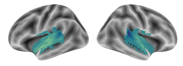 _images/Connectivity_analyses-voxel_63_0.png