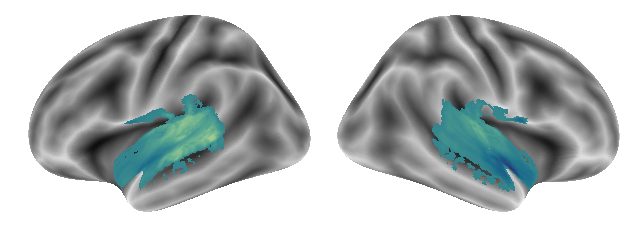 _images/Connectivity_analyses-voxel_65_0.png