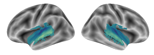 _images/Connectivity_analyses-voxel_69_0.png