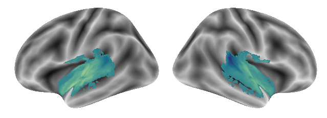 _images/Connectivity_analyses-voxel_71_0.png