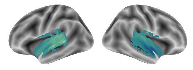 _images/Connectivity_analyses-voxel_73_0.png