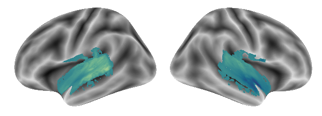 _images/Connectivity_analyses-voxel_82_0.png