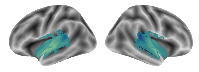 _images/Connectivity_analyses-voxel_88_0.png