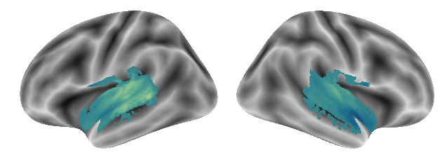 _images/Connectivity_analyses-voxel_90_0.png