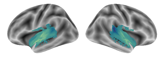 _images/Connectivity_analyses-voxel_95_0.png