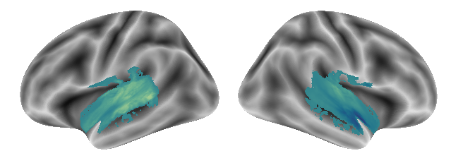 _images/Connectivity_analyses-voxel_96_0.png