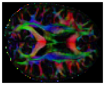 ../_images/diffusion_imaging_28_0.png