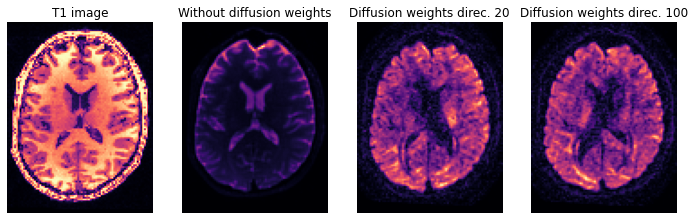 ../_images/diffusion_imaging_7_1.png
