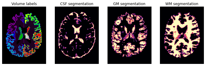 ../_images/diffusion_imaging_8_1.png