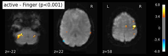 ../_images/statistical_analyses_MRI_44_1.png