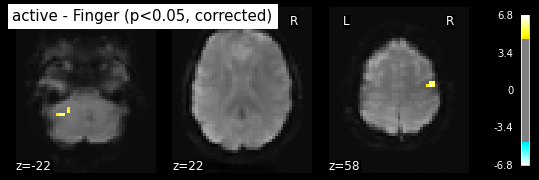 ../_images/statistical_analyses_MRI_47_1.png