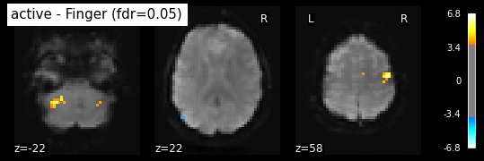 ../_images/statistical_analyses_MRI_50_1.png