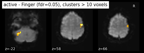 ../_images/statistical_analyses_MRI_53_0.png