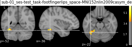 ../_images/statistical_analyses_MRI_70_0.png